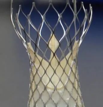 Artificial Heart Valve